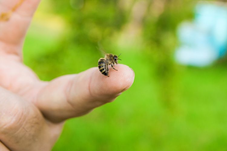 bee sting 