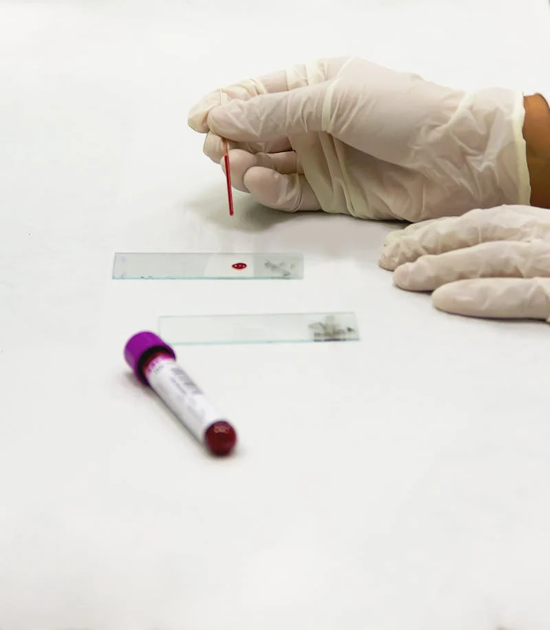 Blood being tested on a slide
