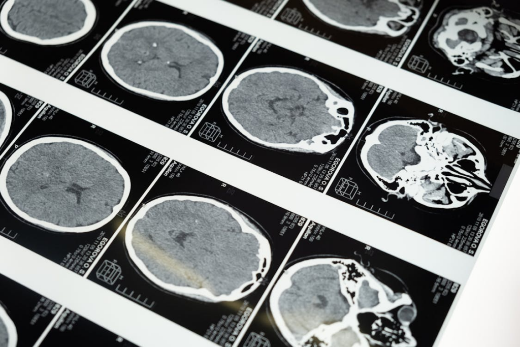 maximum age - brain scans