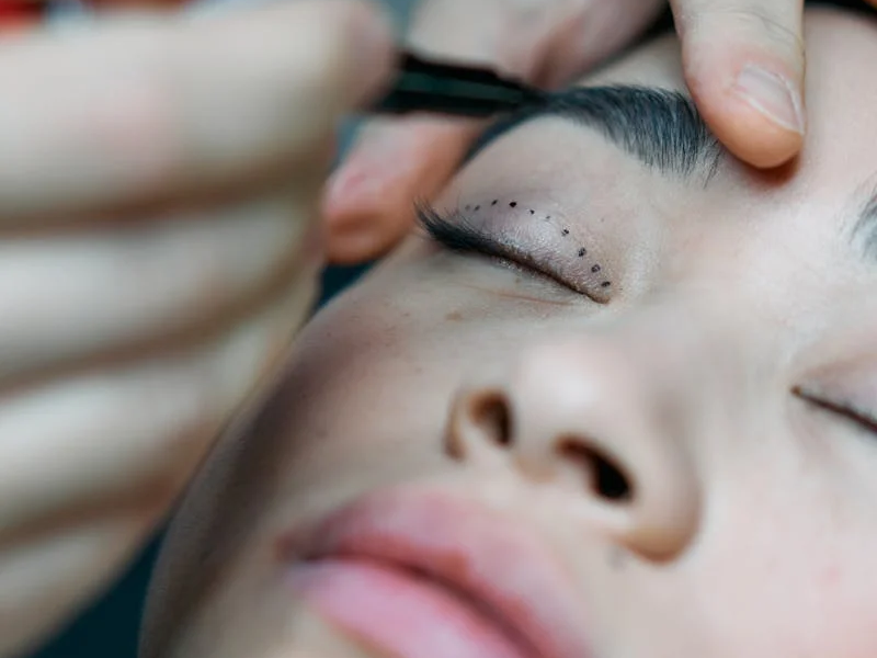woman about to undergo cosmetic surgery