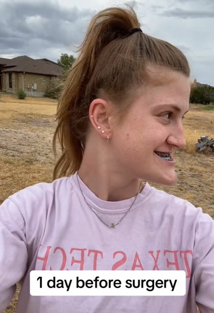 A side-profile image of another woman needing a similar procedure. Grass and a house in the background.
