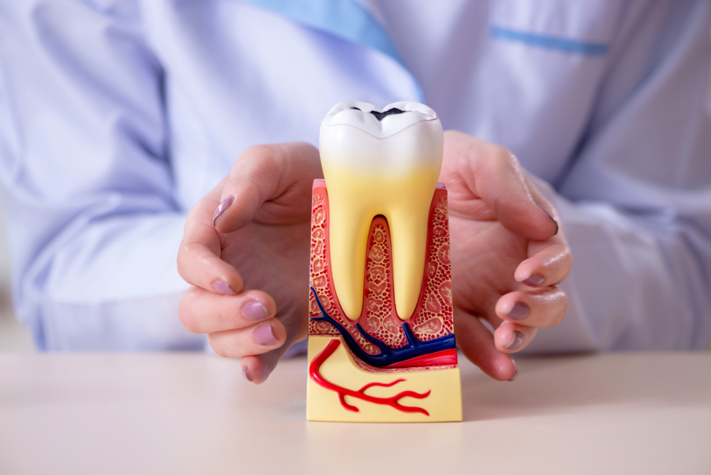 Check up nerve in molar tooth in oral health care concept.
