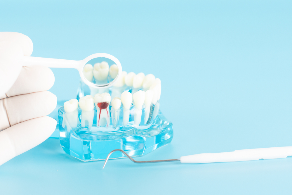 Check up nerve in molar tooth in oral health care concept.
