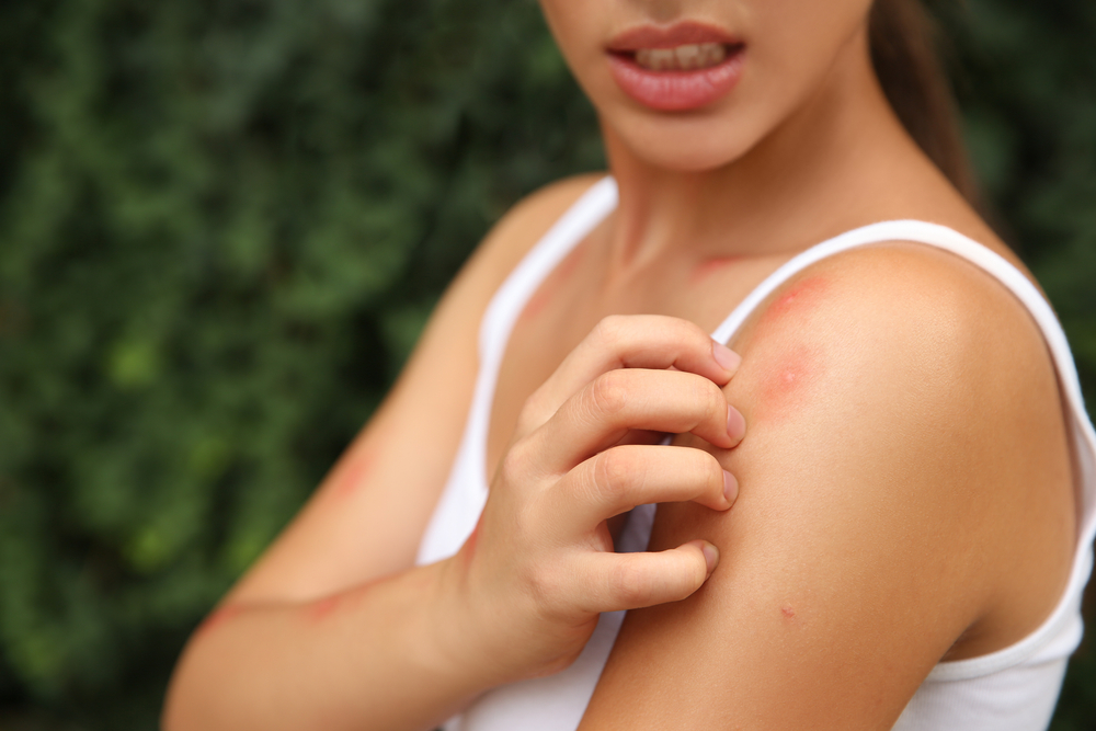 mosquito on human skin at sunset