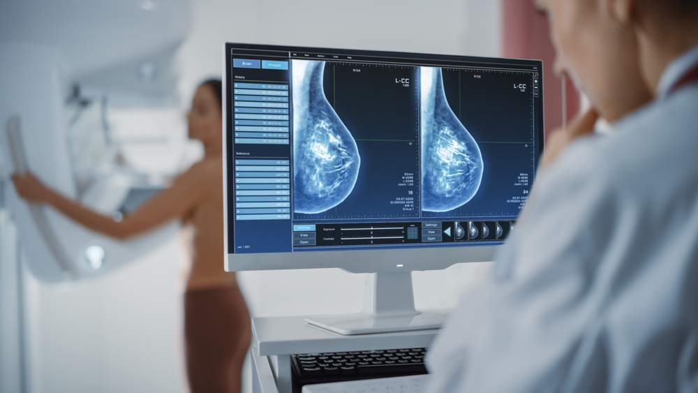 Computer Screen in Hospital Radiology Room: Beautiful Multiethnic Adult Woman Standing Topless Undergoing Mammography Screening Procedure. Screen Showing the Mammogram Scans of Dense Breast Tissues.
