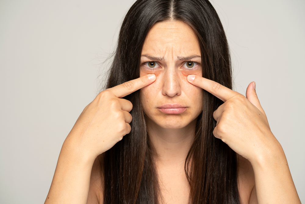 a young unhappy woman touches her undereyes on a gray background
