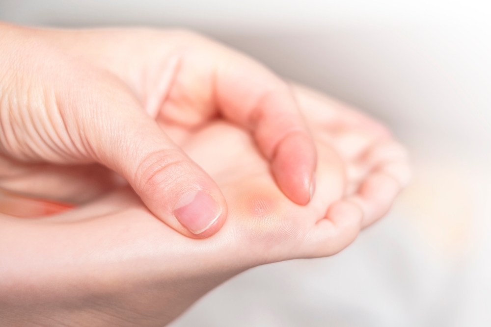 Close up of calluses. Problem skin on the steps of a teenager.