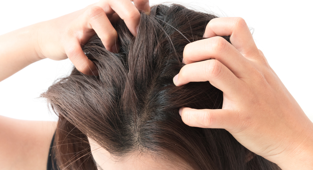 Closeup woman hand itchy scalp, Hair care concept
