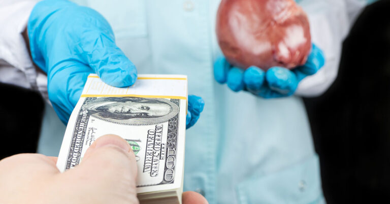 How Much Are Your Organs Worth On The Black Market - Featured image