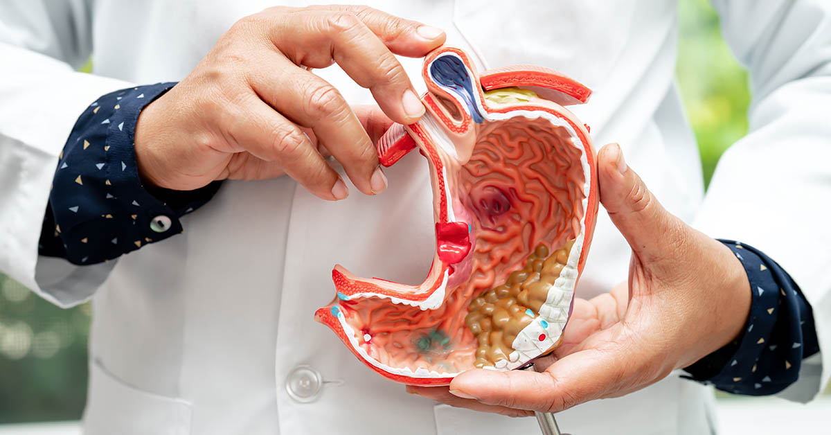 Stomach Cancer Often Develops Silently. Here Are 9 Early Symptoms to Look Out For