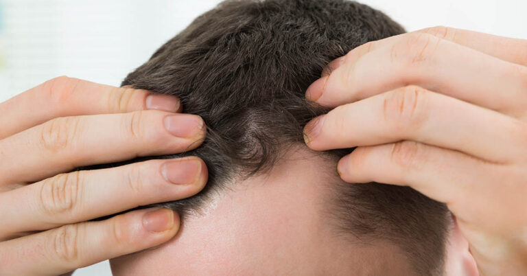 Signs On Your Face and Head That Could Indicate Heart Trouble - Featured image