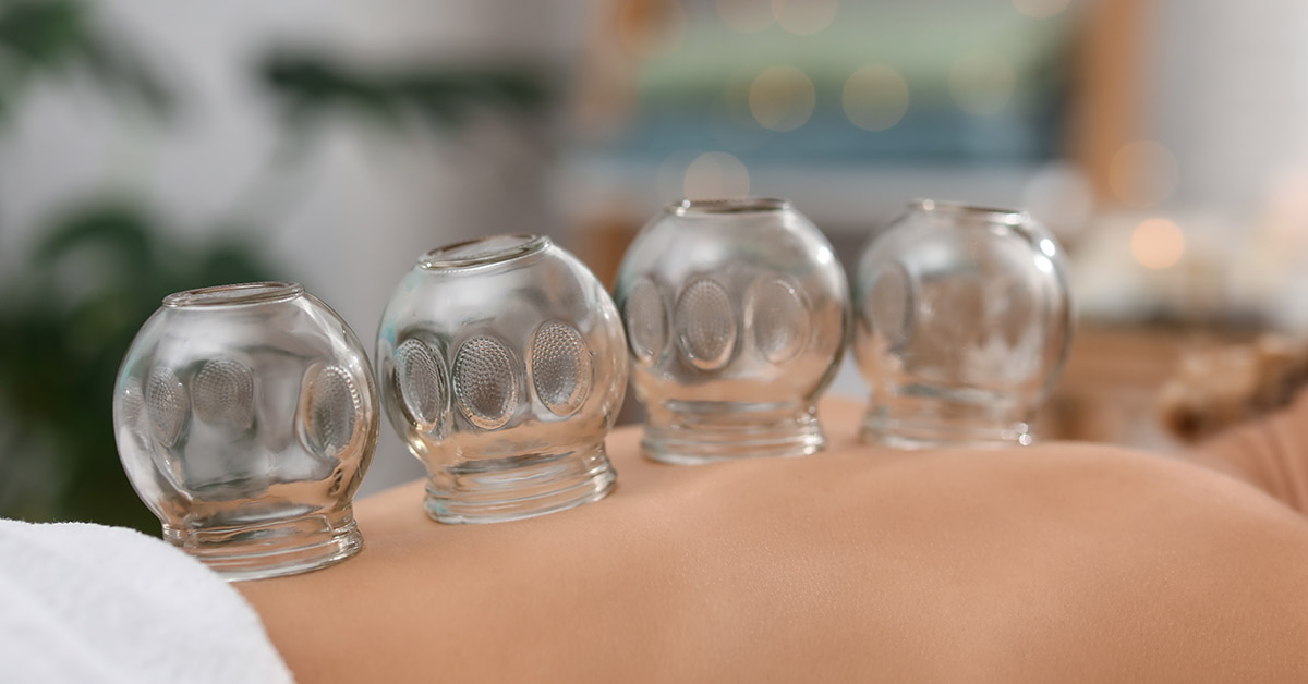 Olympians Spotted With ‘Cupping’ Marks On Their Bodies. Does It Work? Here’s What The Science Says