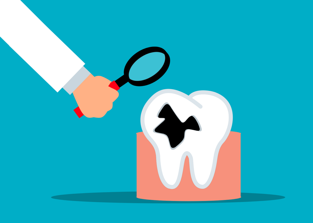 Sometimes dentist scare tactics are worthwhile