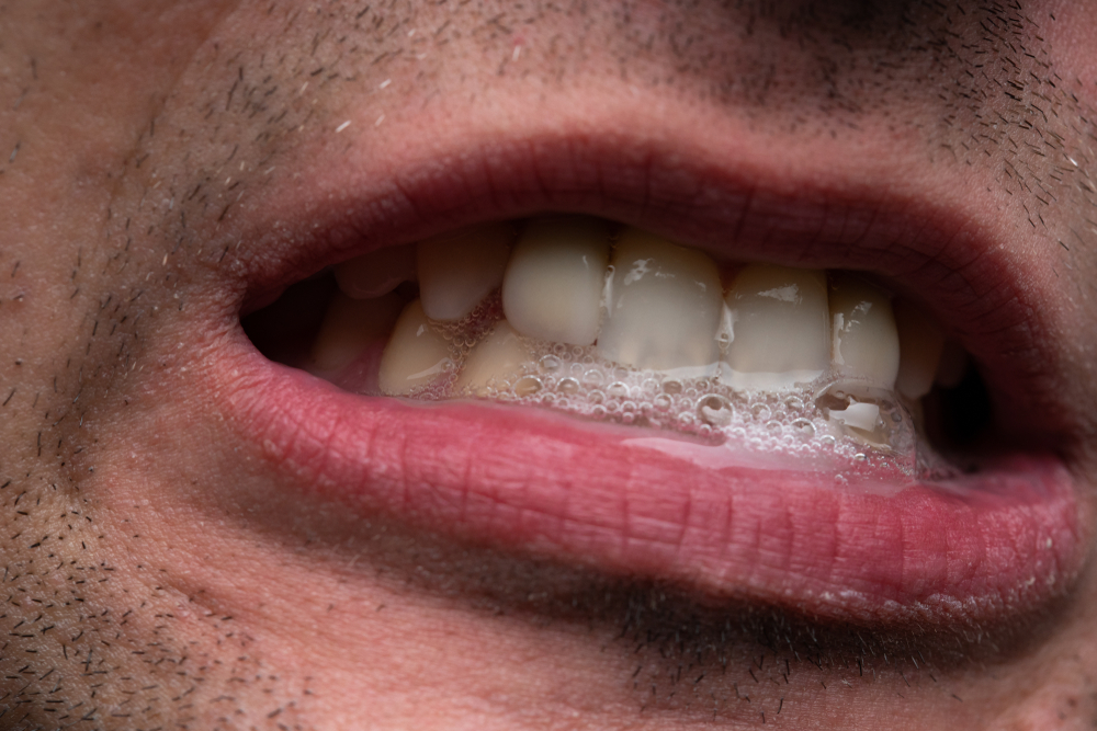 Image of young man with saliva, showing teeth
