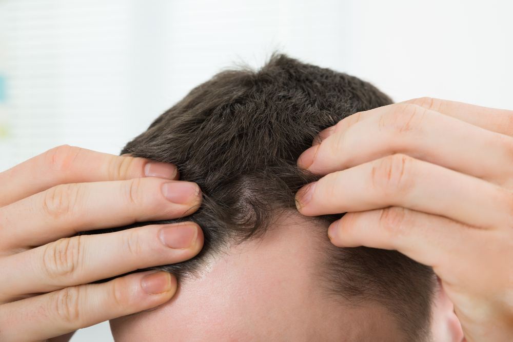 Closeup of mid adult man checking hairline at home
