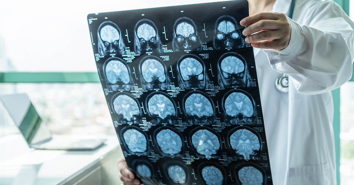 Neurologist reveals the single scariest thing she sees people doing to their brains