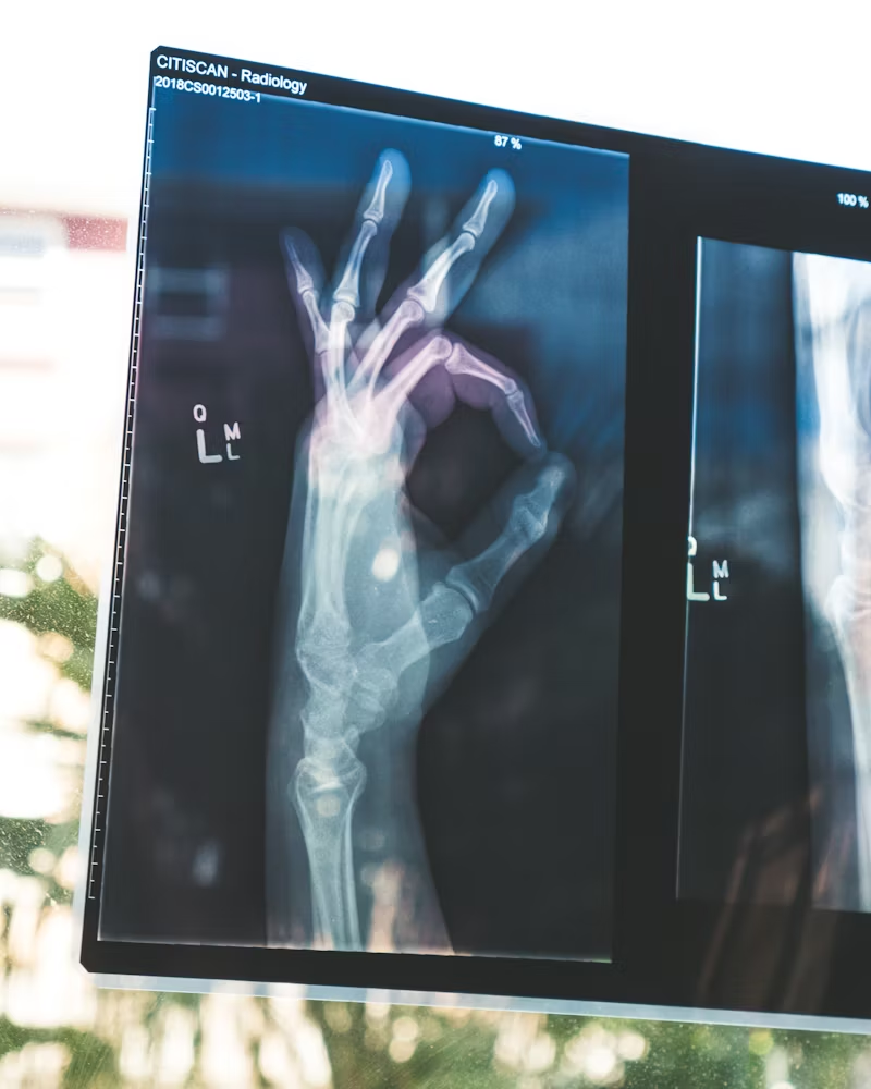 X-Ray of a hand making the OK symbol