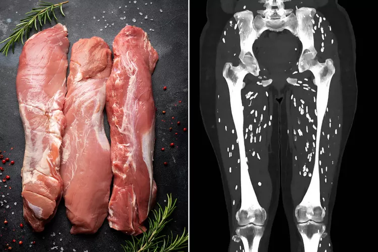 Raw Pork beside a scan of parasites in someones legs