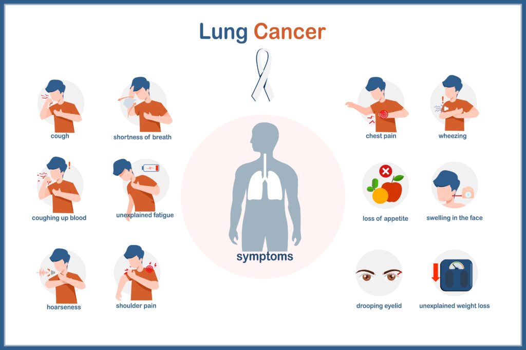 Vector medical illustration of lung cancer symptoms in flat style.Human lungs and males in various postures when having lung cancer such as bloody cough,chest pain,shortness of breath and weakness