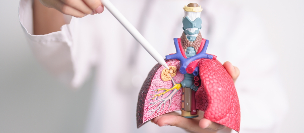 Doctor with Smoker and normal Lung anatomy for Disease. Lung Cancer, Asthma, Chronic Obstructive Pulmonary or COPD, Bronchitis, Emphysema, Cystic Fibrosis, Bronchiectasis, Pneumonia and world Lung day