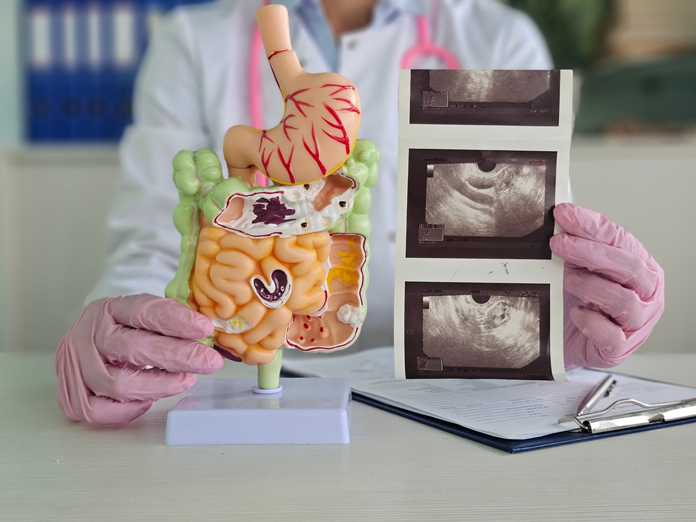 Doctor examines digestive system model and ultrasound image