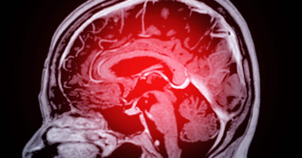 14 Steps To Help Prevent 50 Million Cases of Dementia By 2050