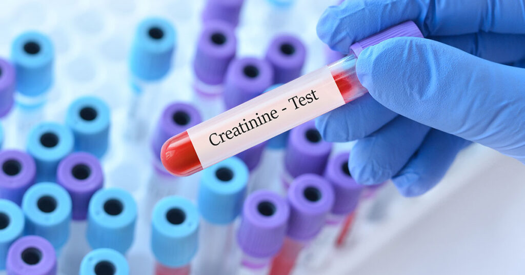 Creatinine Levels: When to Worry About High and Low Creatinine - Featured image