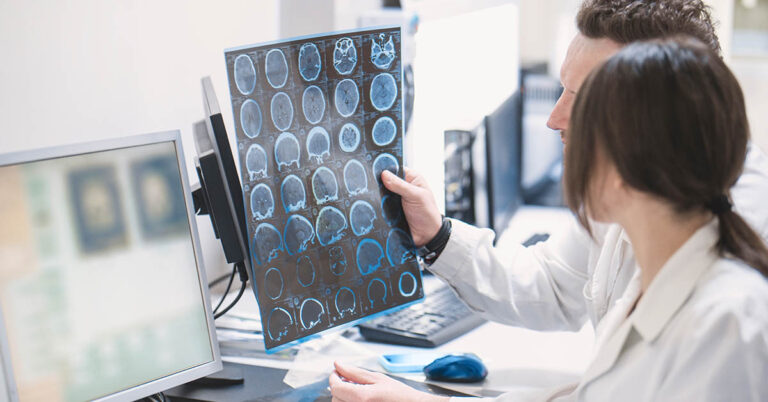 Strokes Are On The Rise In Young People, And These Are The Reasons Why - Featured image