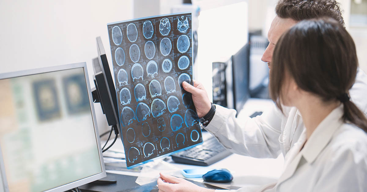 Strokes Are On The Rise In Young People, And These Are The Reasons Why