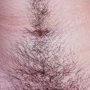 Thyroid Issues and Hair Growth