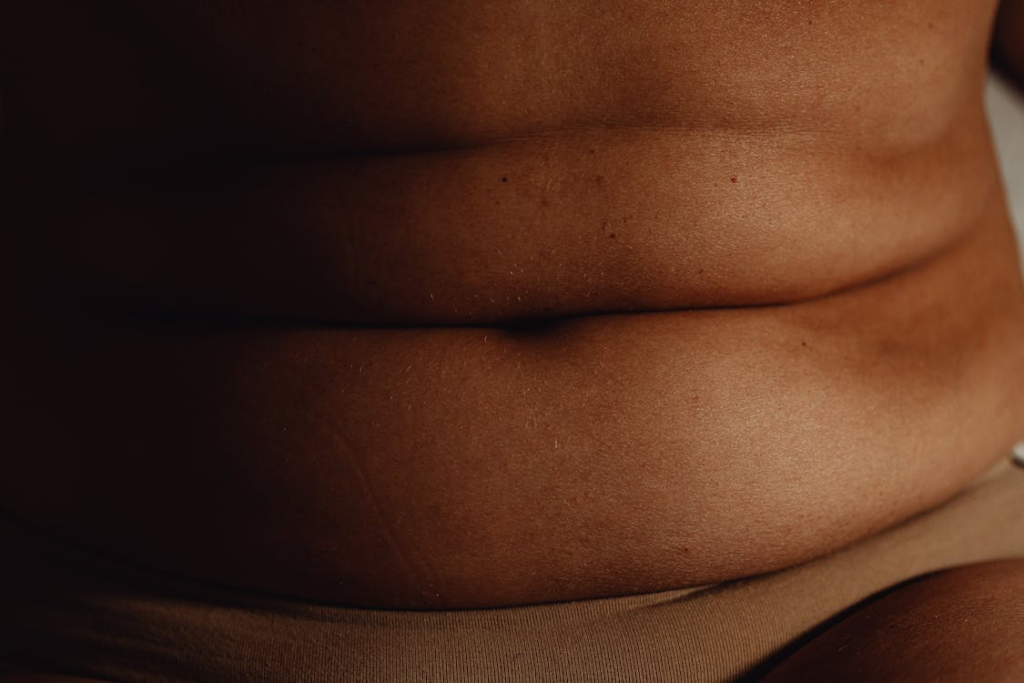 Obesity: A Key Contributor