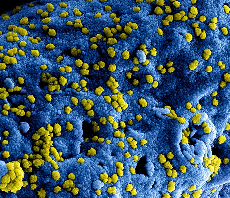 bacteria