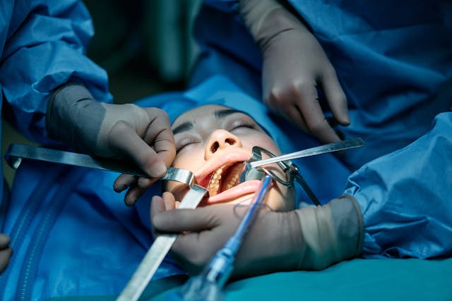 docotors opening mouth