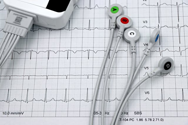 heart beat and dementia heart conditions
