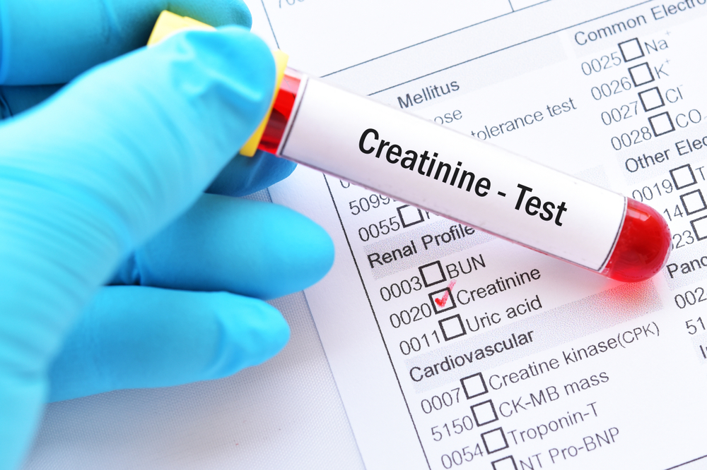 Blood sample for creatinine test, diagnosis for renal disease