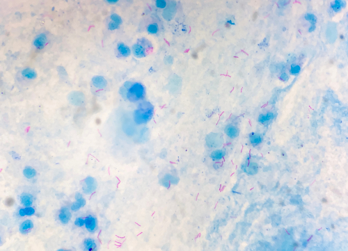 bacteria