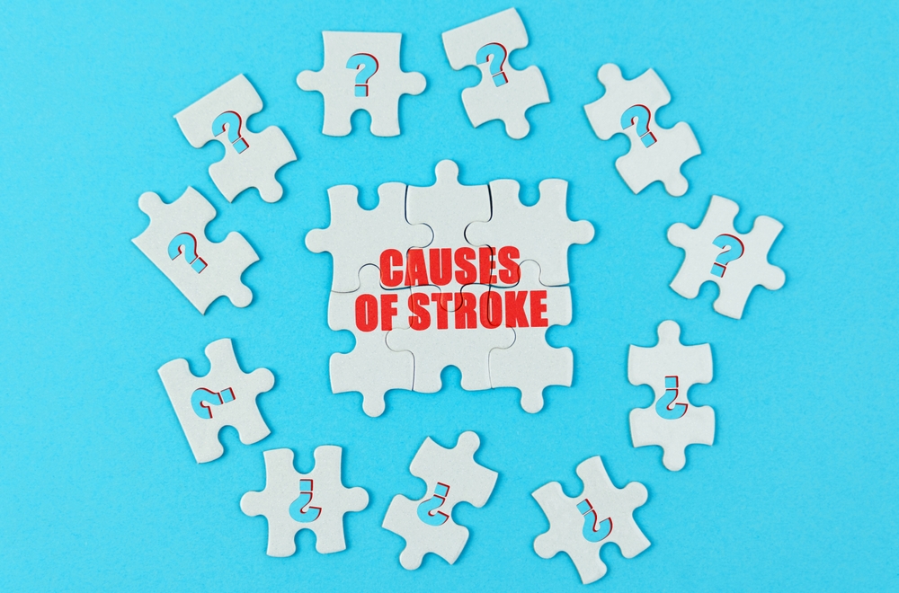 Medical concept. On a blue surface are puzzles with a question mark, in the center with the inscription - causes of stroke