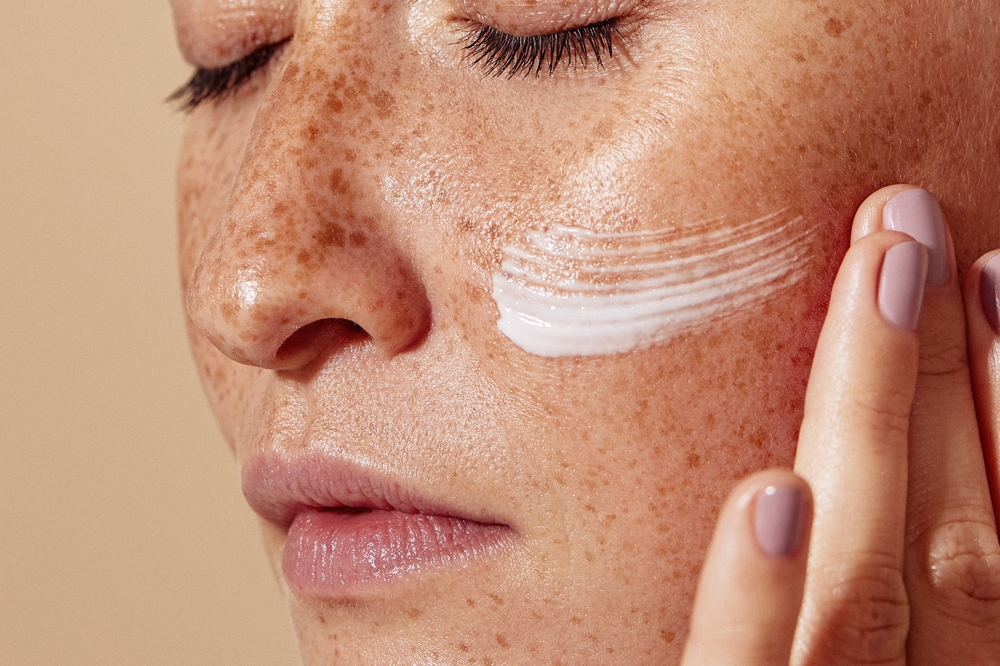 Close-up of female face with freckled skin. High-detailed shot of woman skin applying moisturizer.