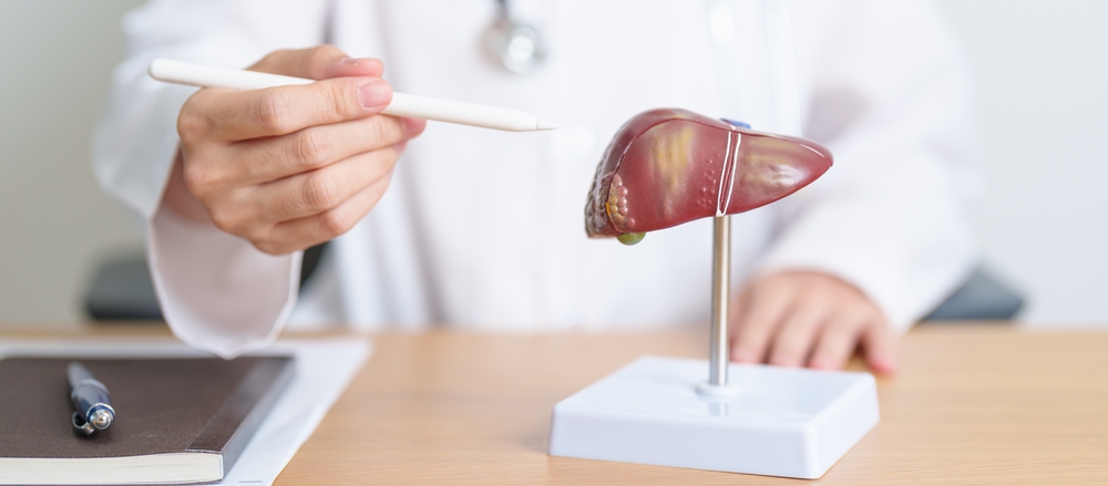 Doctor with human Liver anatomy model. Liver cancer and Tumor, Jaundice, Viral Hepatitis A, B, C, D, E, Cirrhosis, Failure, Enlarged, Hepatic Encephalopathy, Ascites Fluid in Belly and health concept
