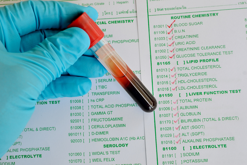 Blood sample for routine clinical chemistry