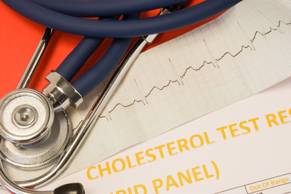 Influence of elevated or high levels of cholesterol and fats in blood to heart, heart rhythm and cardiac function. On red background lie stethoscope, EKG tape and result of cholesterol blood test
