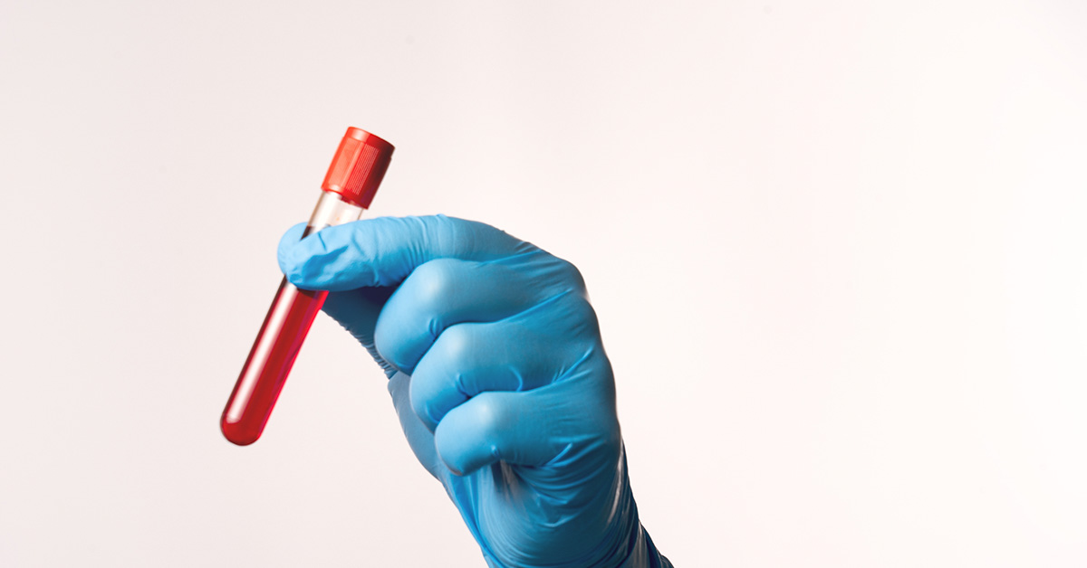6 Things To Do Before Getting a Blood Test, According to Doctors