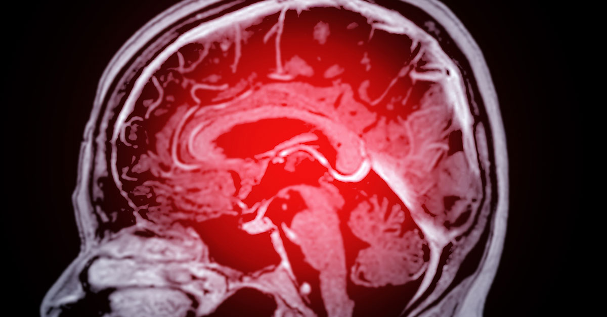 Just One Habit in Your 40s Can Lead to Faster Brain Aging