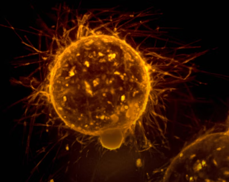 close-up of a tumorous growth in the body