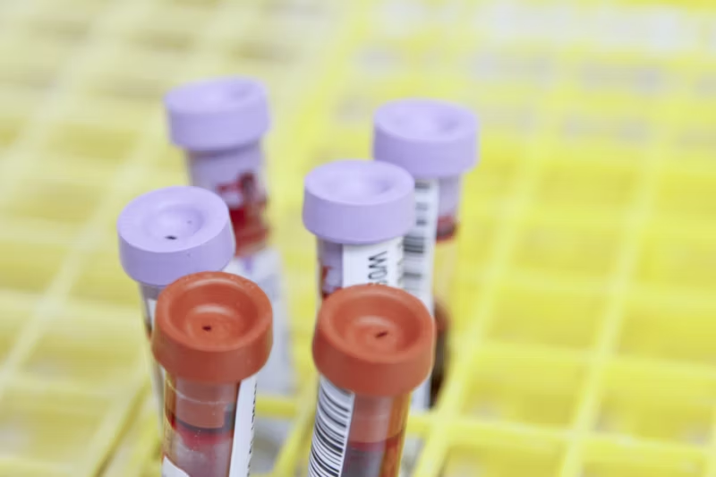 blood to be tested