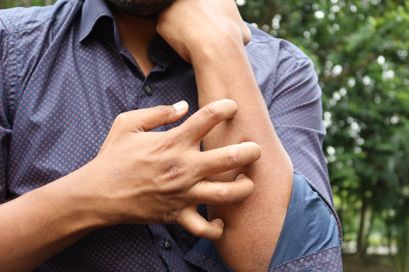 person itching their arm