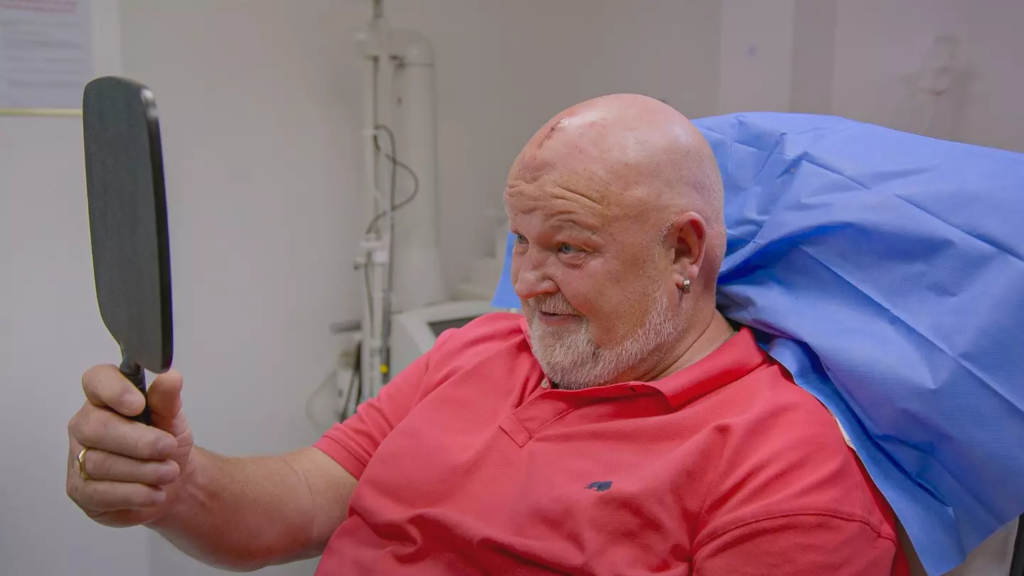 Clyde was over the moon with the results of the procedure 