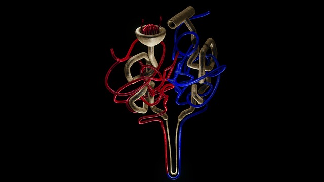 Nephron, kidney , kidney stones