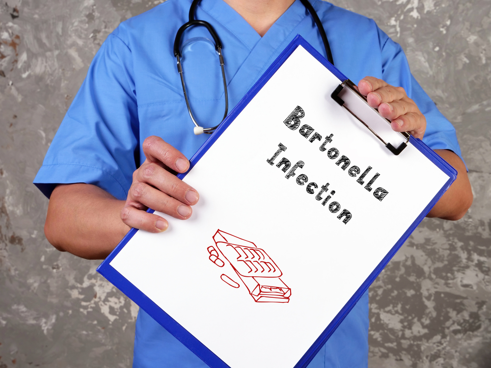 Medical concept meaning Bartonella Infection with inscription on the piece of paper.