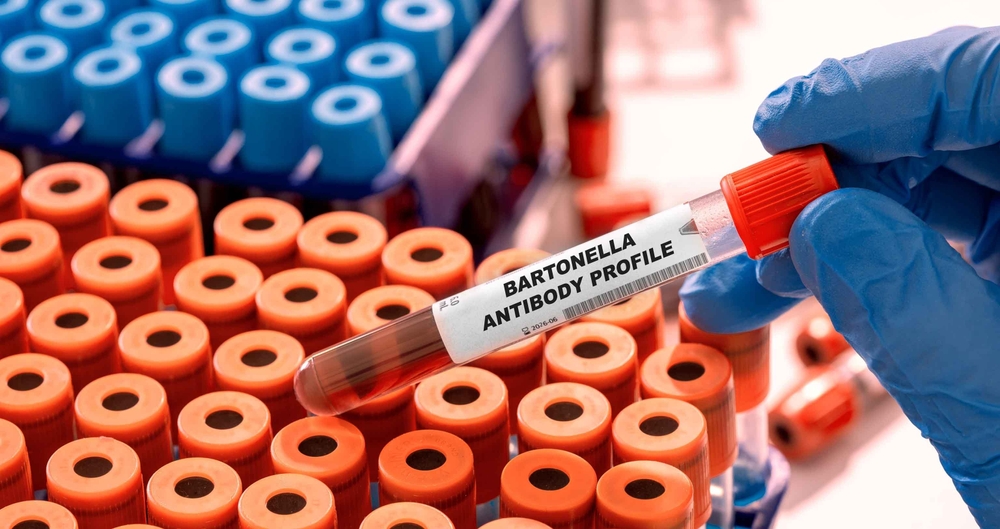 Bartonella Antibody Profile Test tube with blood sample in infection lab

